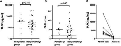 Improved atopic dermatitis accompanied by pompholyx